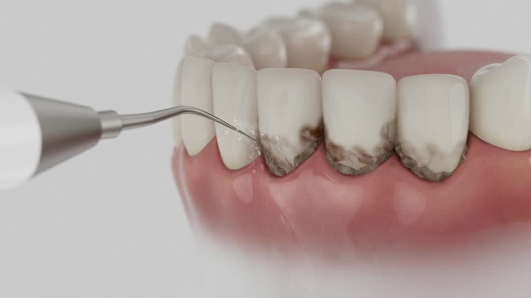 Trusted Wisdom Tooth Removal service in Gainesville, VA - Dentist Open Now